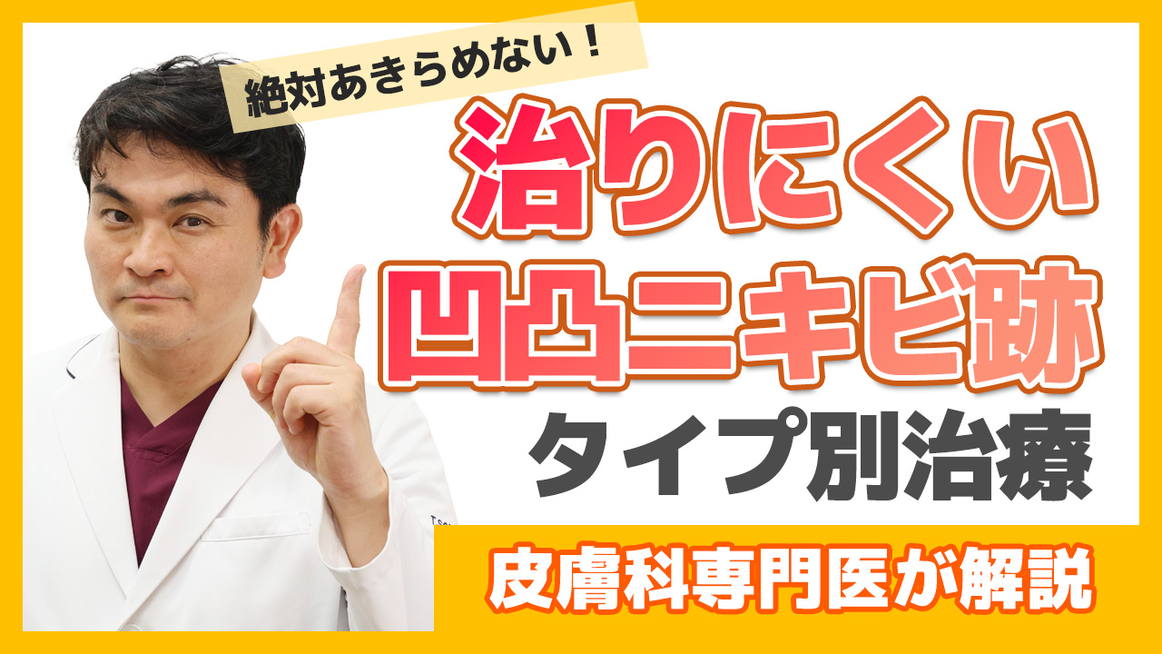 YouTubeロング動画