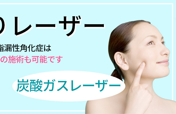 ほくろ取りレーザー