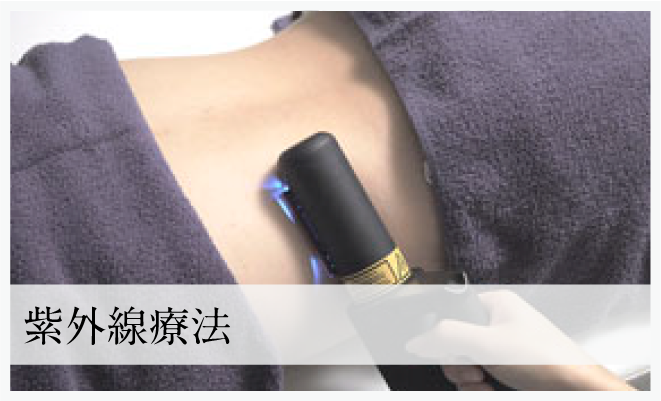 紫外線療法